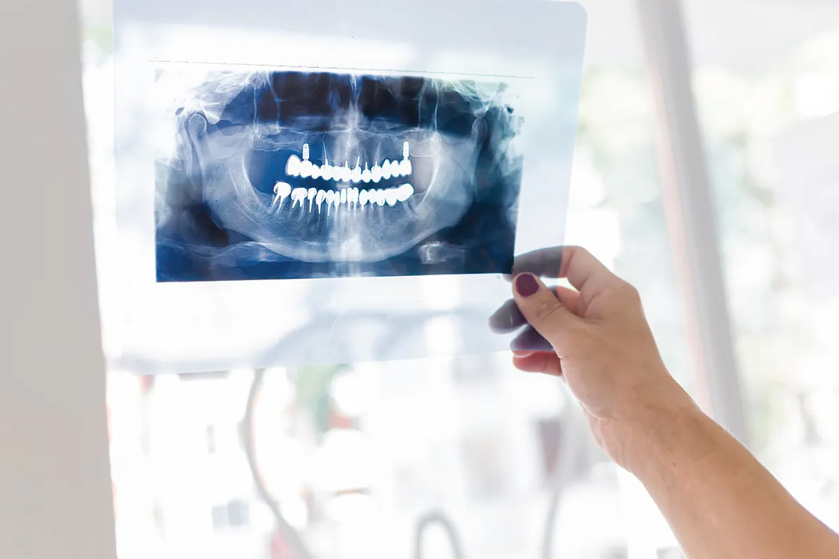 Rentgenodiagnostyka. Znaczenie w implantologii stomatologicznej